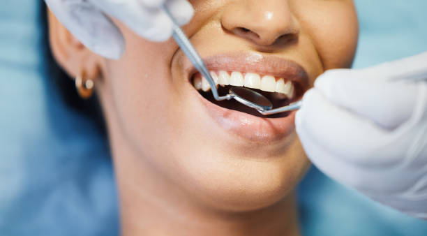 Best Dentist for Tooth Abscess  in Caledonia, MN